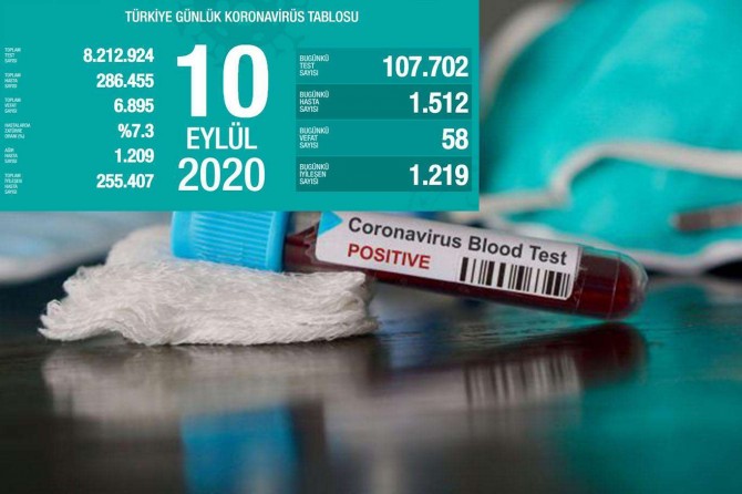 Turkey records 1,512 daily confirmed cases of COVID-19