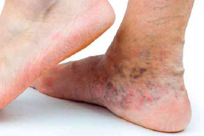 Coronavirus döneminde varis artıyor!