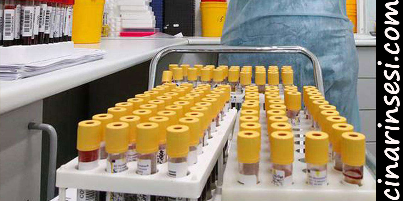 Rusya Covid-19'da 94 yeni ölüm bildirdi