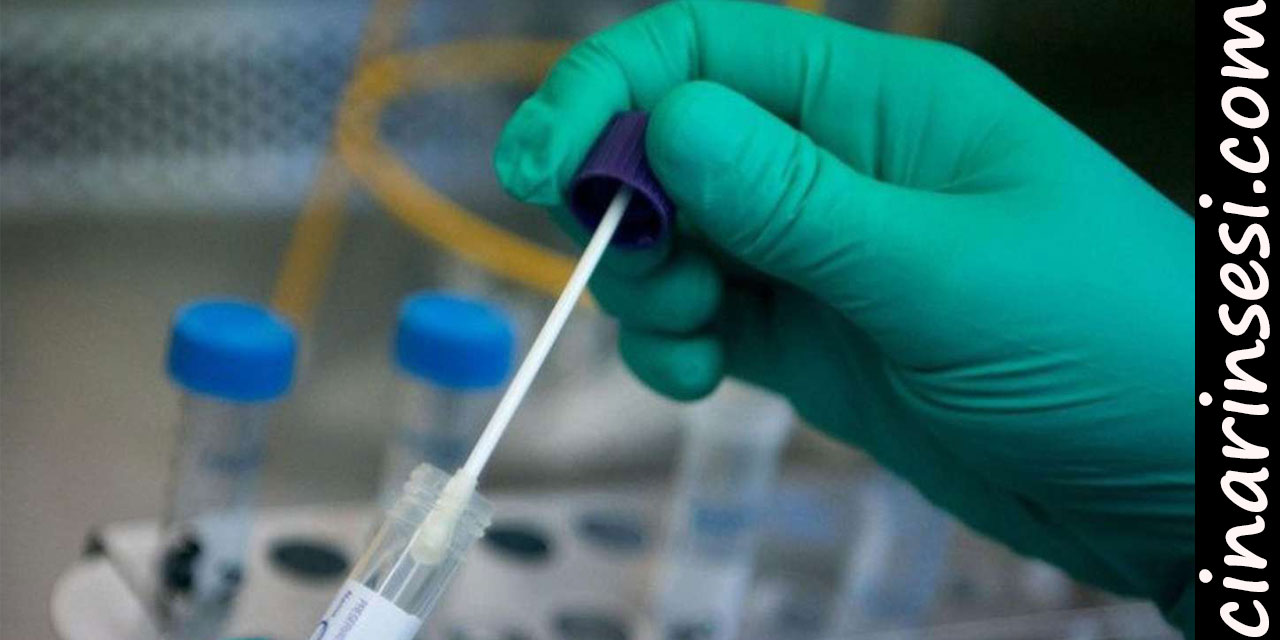 İran'da Covid-19 vakaları 400 bini aştı