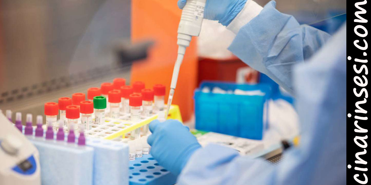 Türkiye'de Covid-19'dan 1527 yeni tanı kondu 1102 hasta iyileşti