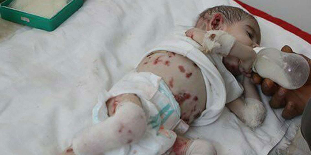 ABD'nin ambargoları çocukların hayatına mal oluyor