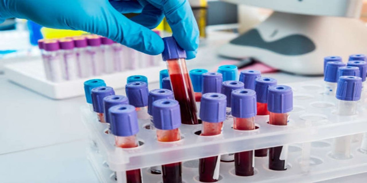 Hindistan'da Coronavirus bilançosu ağırlaşıyor: Son 24 saatte 93 bin yeni tanı kondu