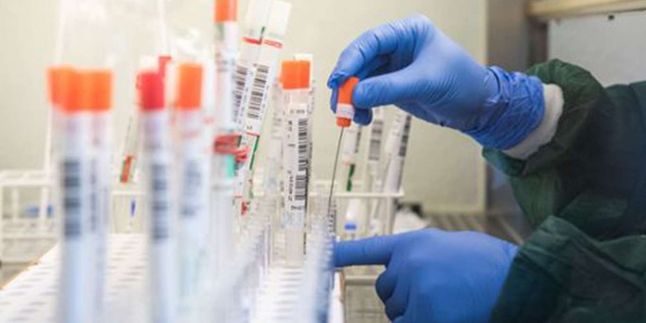 Türkiye'de son 24 saatte 55 kişi Covid-19 nedeniyle öldü, 1402 hasta şifa buldu