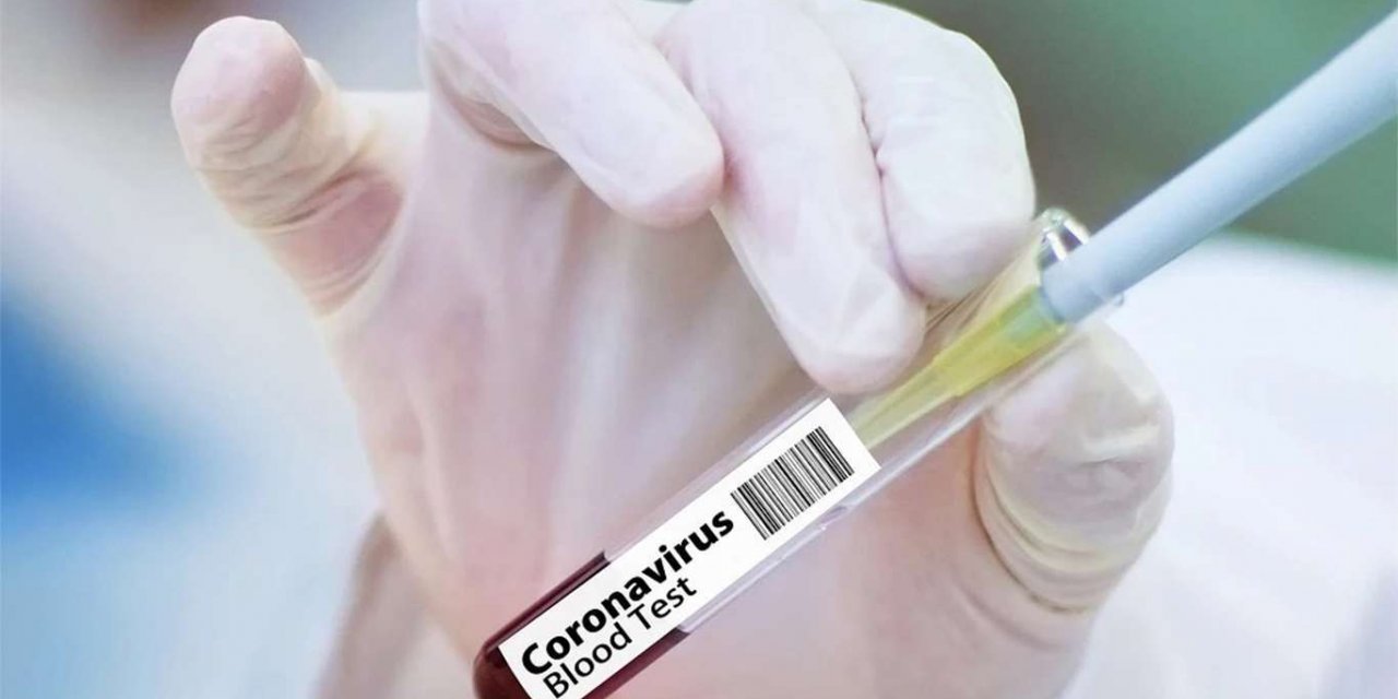 Fransa'da Coronavirus vaka sayıları artıyor