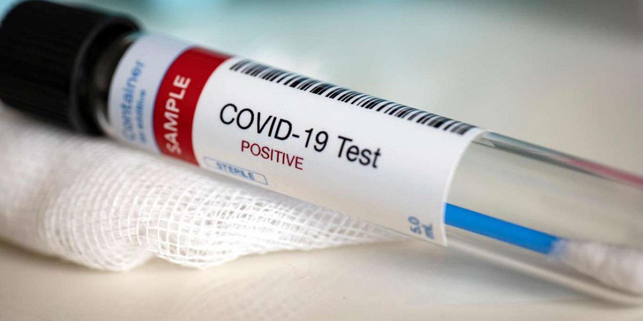 Sağlık Bakanı Koca'dan Covid-19 testi pozitif çıkanlara uyarı