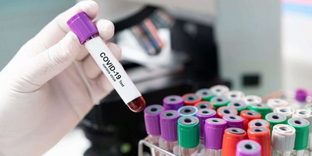 ABD'de korkunç Coronavirus rekoru: Son 24 saatte 132 bin yeni vaka