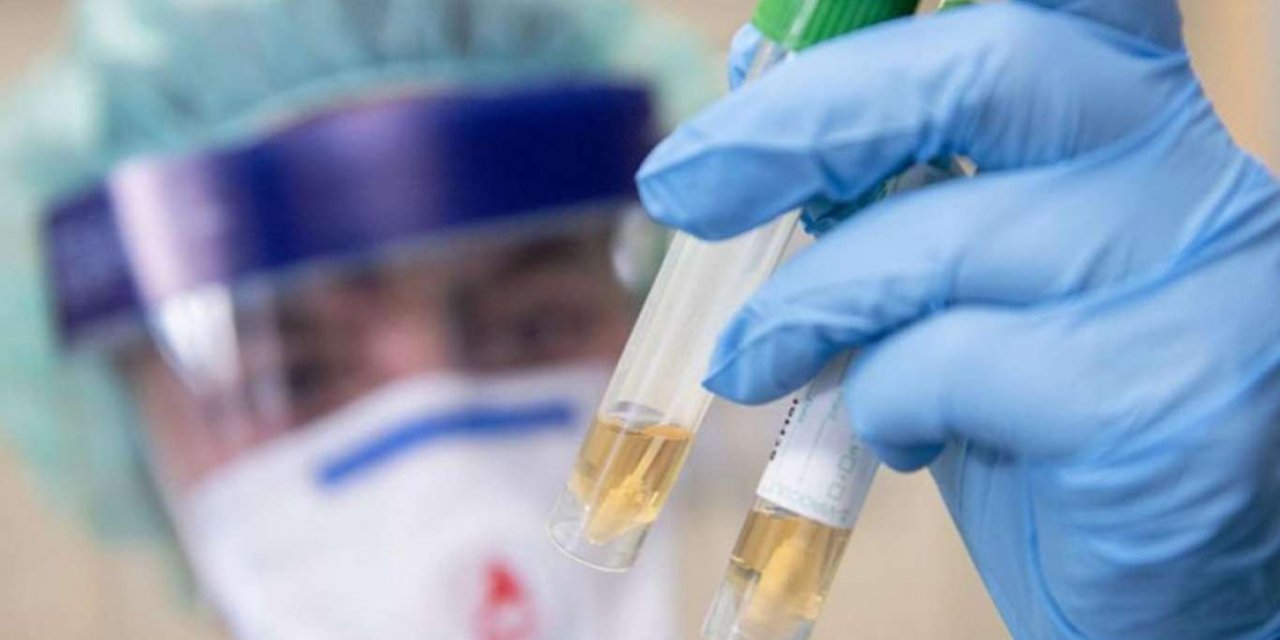 Russia records 20,977 daily confirmed cases of COVID-19