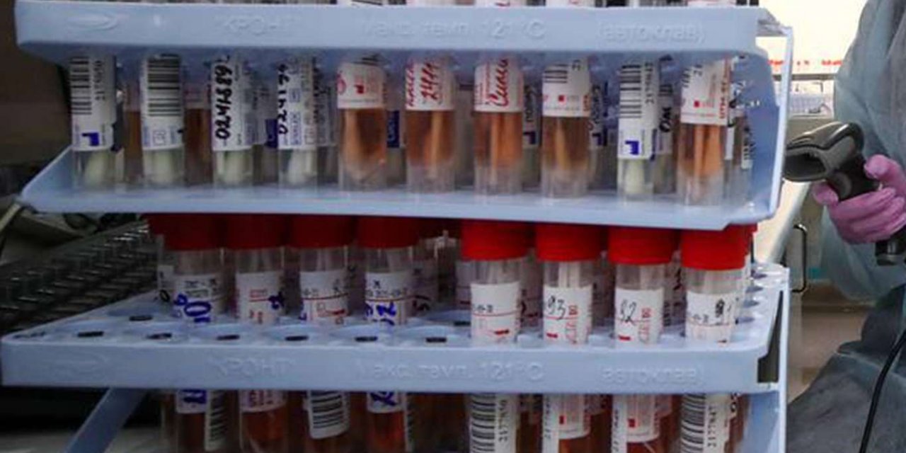 Turkey reports 86 new deaths from coronavirus in the last 24 hours