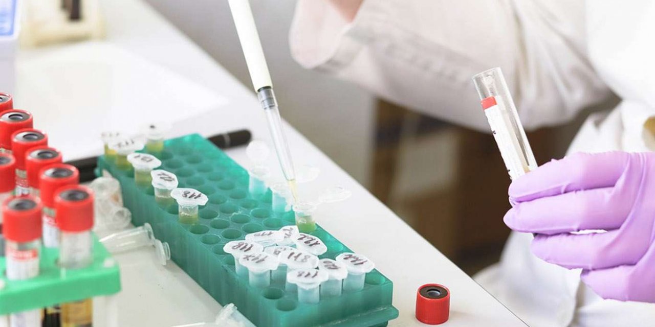 Rusya'da bir günde yaklaşık 23 bin Covid-19 vakası tespit edildi