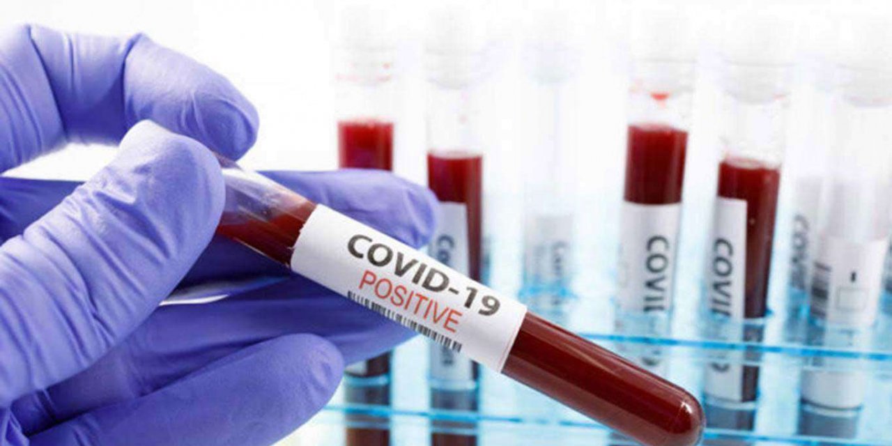 Turkey reports 92 new coronavirus deaths in the last 24 hours