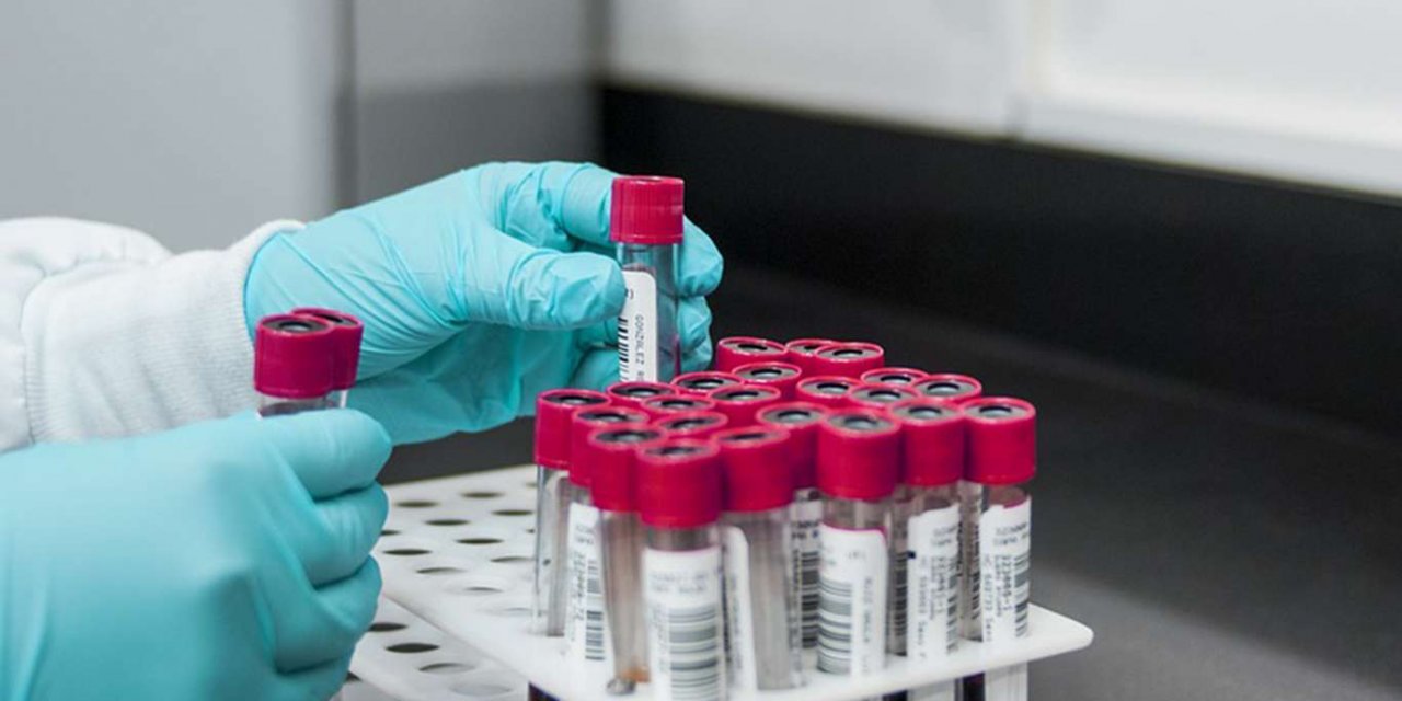 Türkiye'de ilk kez toplam koronavirus vaka sayısı açıklandı