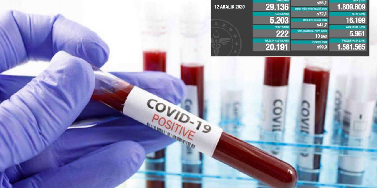 Türkiye'de 222 kişi daha Covid-19 nedeniyle hayatını kaybetti