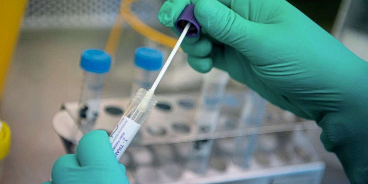 Russia records 28,080 daily confirmed cases of COVID-19