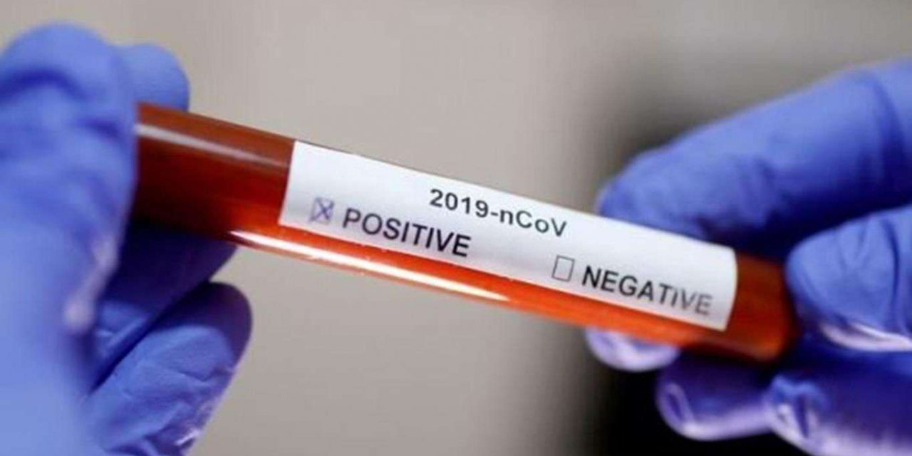 Turkey reports 246 new deaths from coronavirus