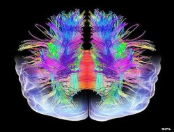 Beyin taraması ile 'rüyaları okumak' mümkün