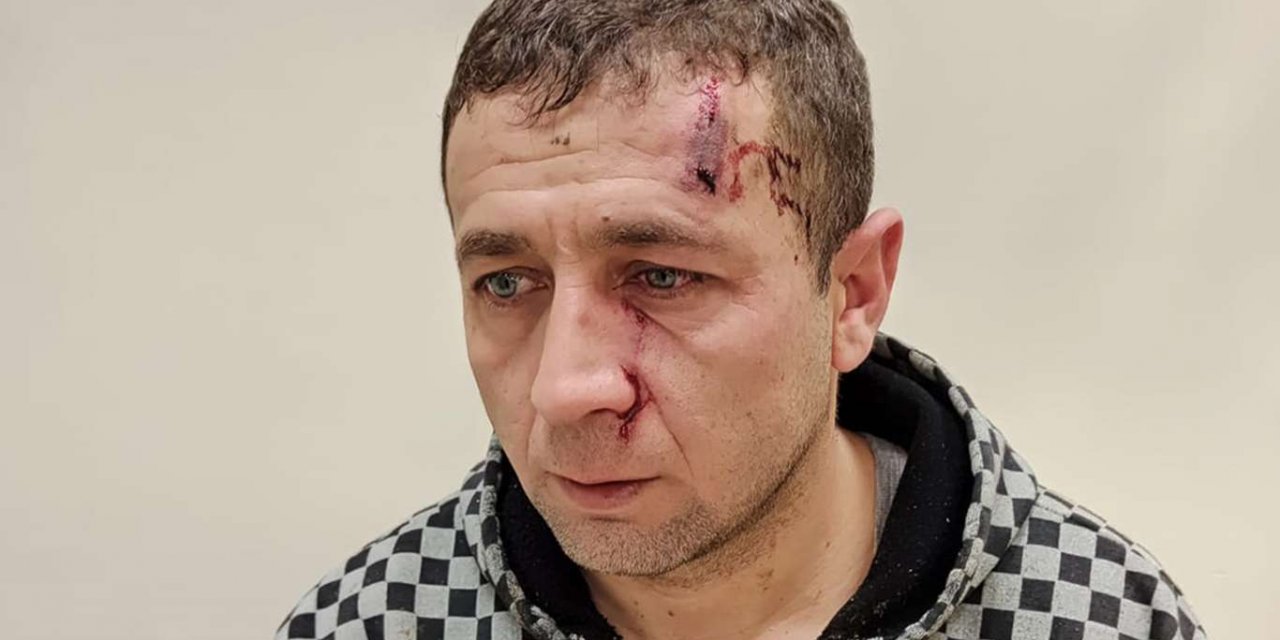 Şanlıurfa Haliliye'de büyükbaş hayvanın tekmelediği veterinerin burnu kırıldı