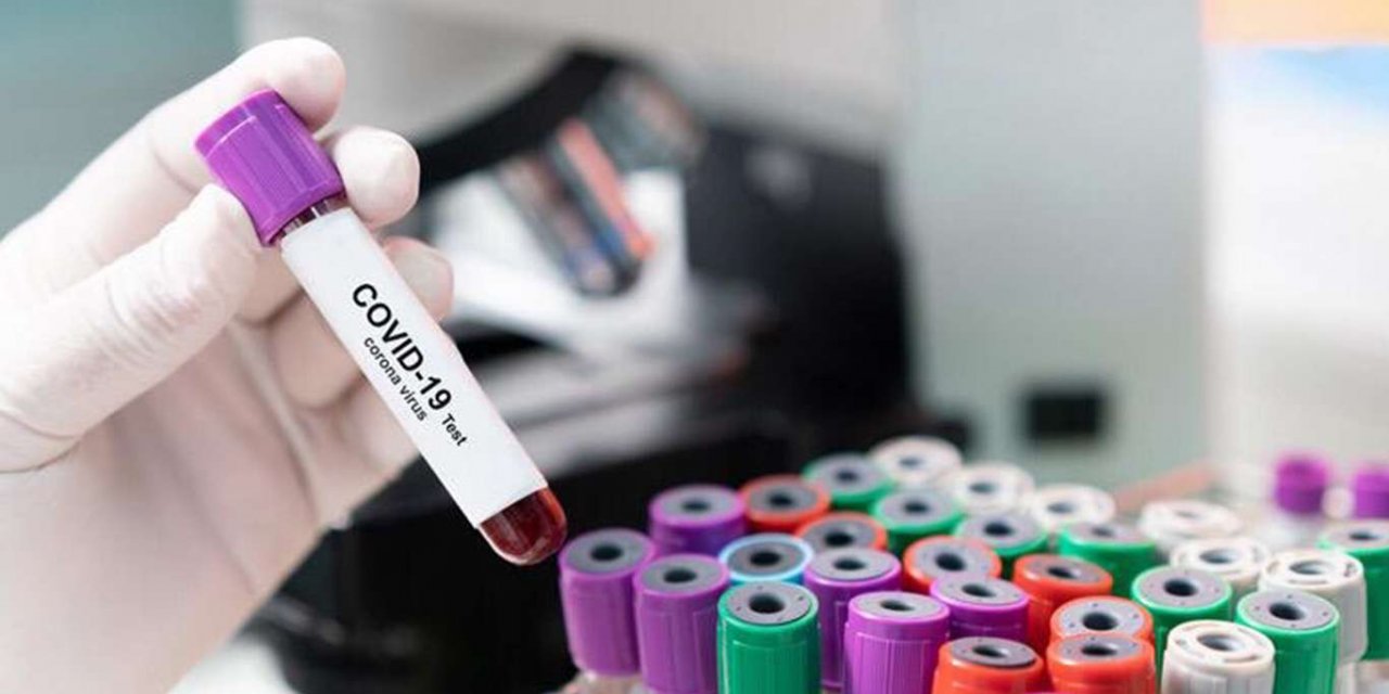 Koronavirus son 24 saatte 15 bin 197 vaka tespit edildi