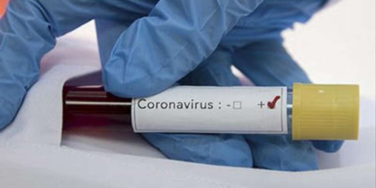 Li Îngîlterê di 24 seatên dawî de ji ber Coronavîrusê 414 kes mirin