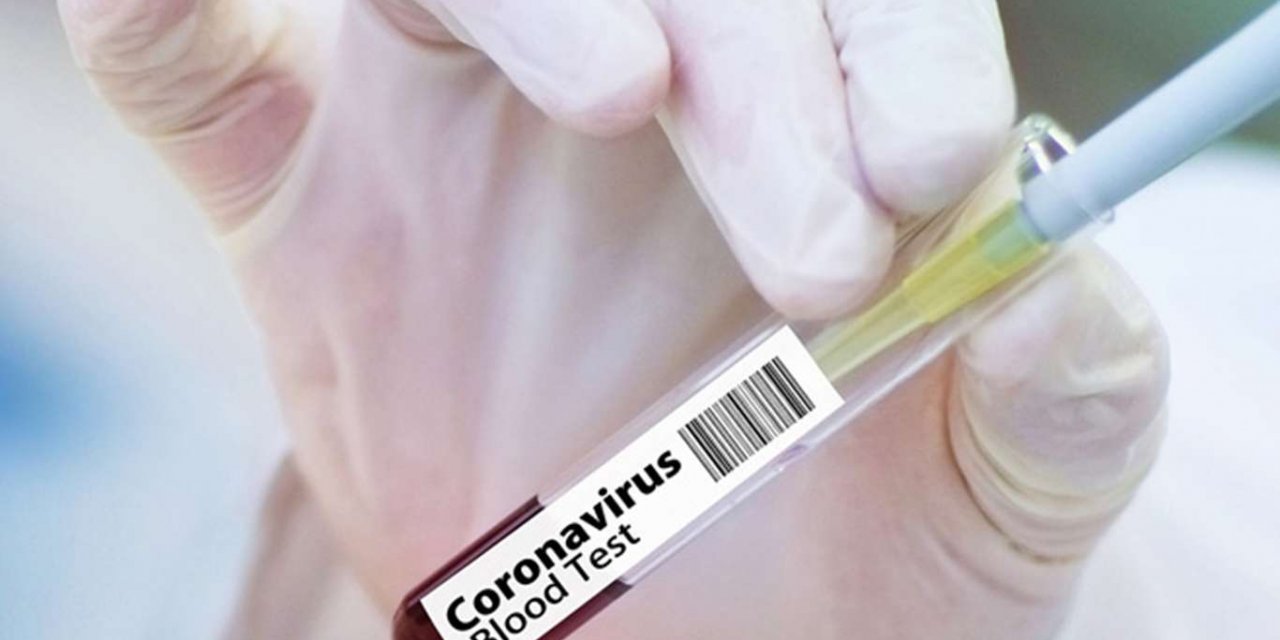 Turkey’s coronavirus death toll exceeds 21,000