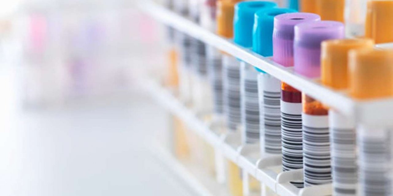 ​Türkiye'de son 24 saatte 197 kişi Covid-19 nedeniyle hayatını kaybetti