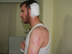 "Hz. Muhammed'i sevdiğimiz için saldırdılar"  video