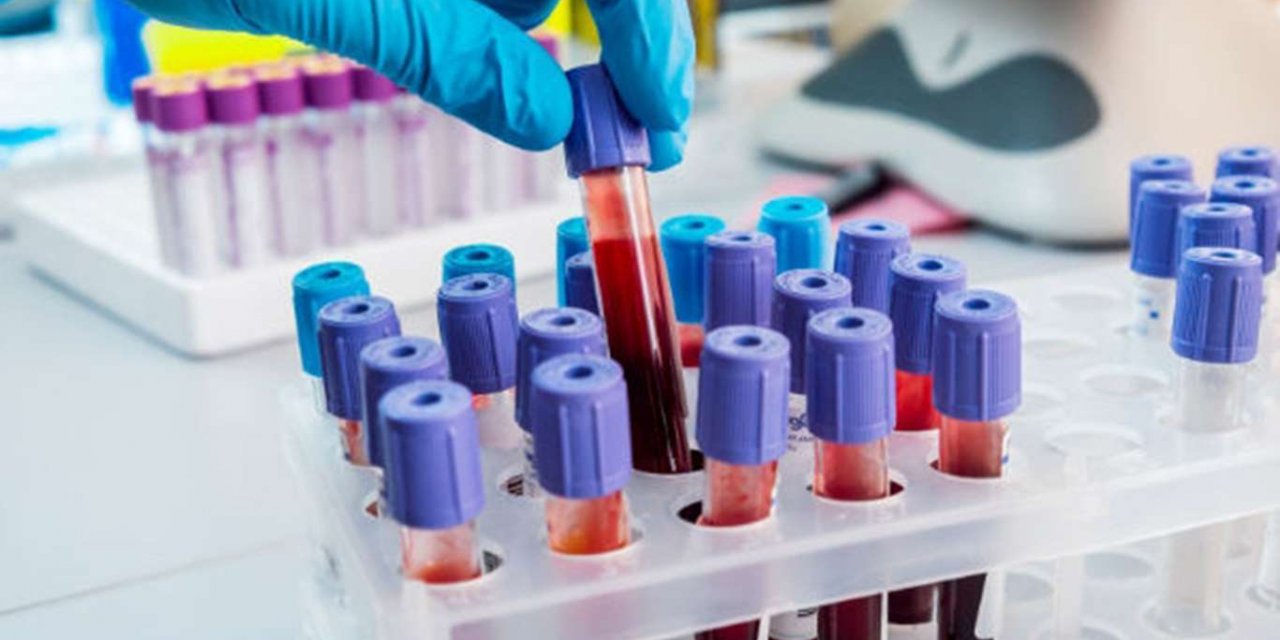 Russia’s coronavirus death toll rises to 60,457