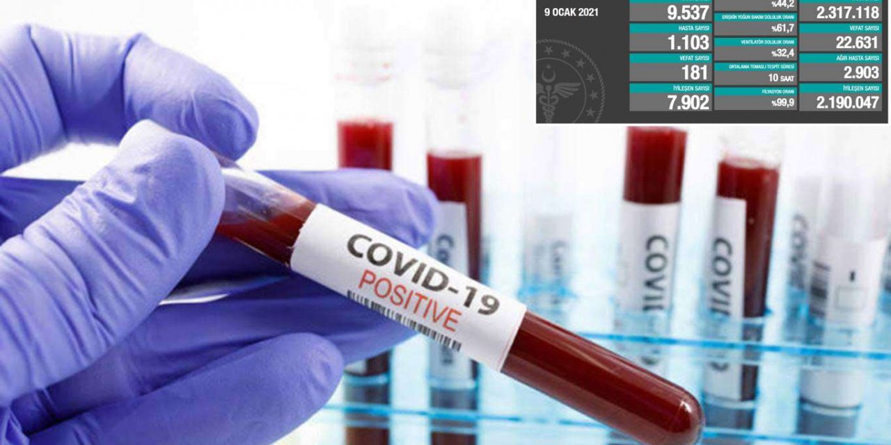 Türkiye'de 181 kişi daha Covid-19 nedeniyle hayatını kaybetti