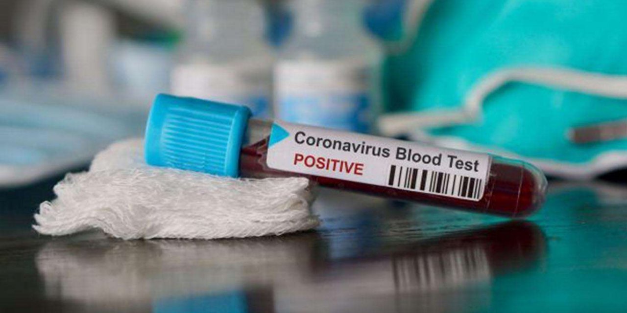 Mexico reports 10,003 daily confirmed cases of COVID19