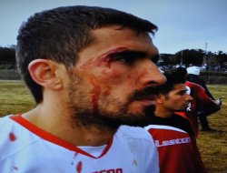 Futbolculara saldırı: 11 yaralı