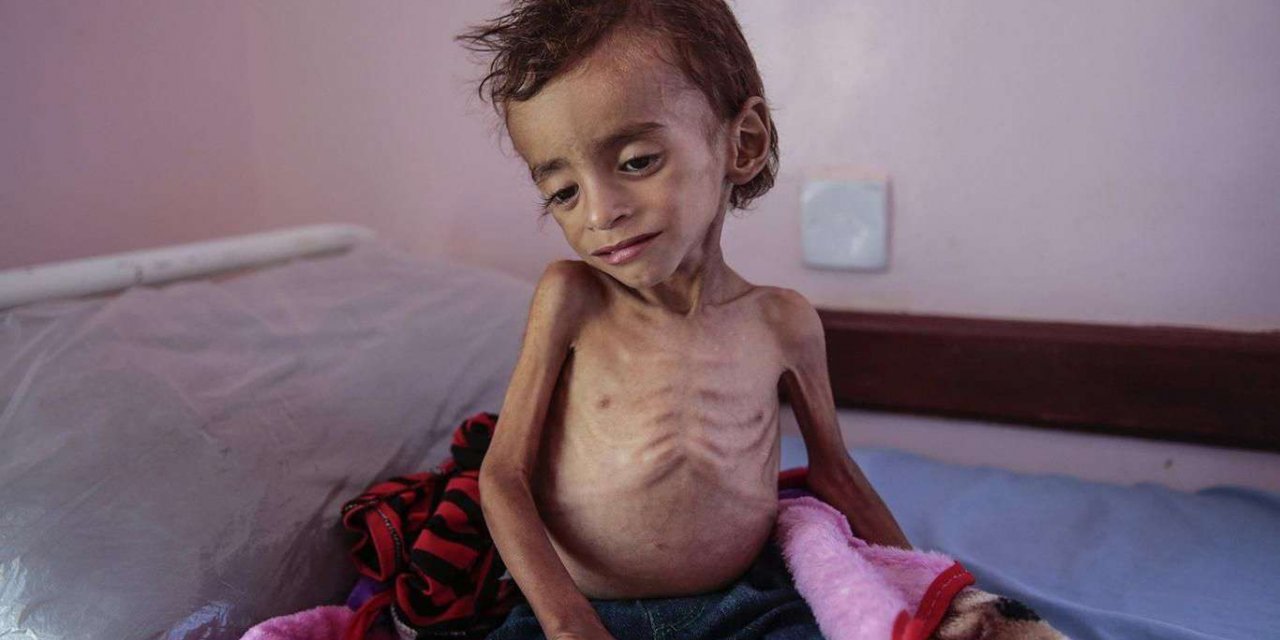 Li Yemenê serê her 10 deqîqeyan carekê zarokek dimire