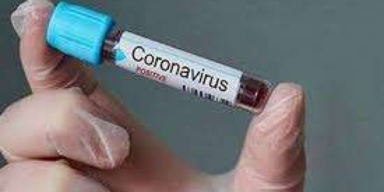 Turkey records 13,755 daily confirmed cases of COVID-19