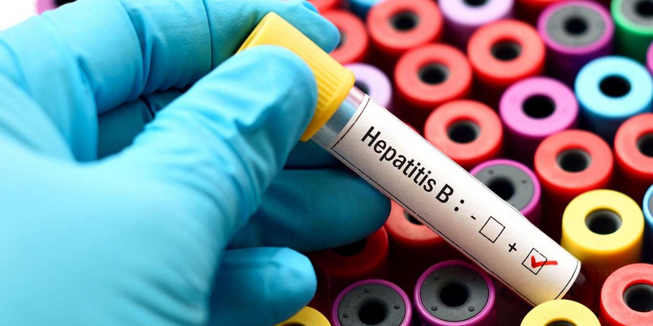 Hepatit, yemek borusu varisi için risk oluşturuyor