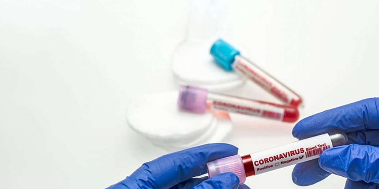 Turkey records 26,182 daily confirmed cases of COVID-19