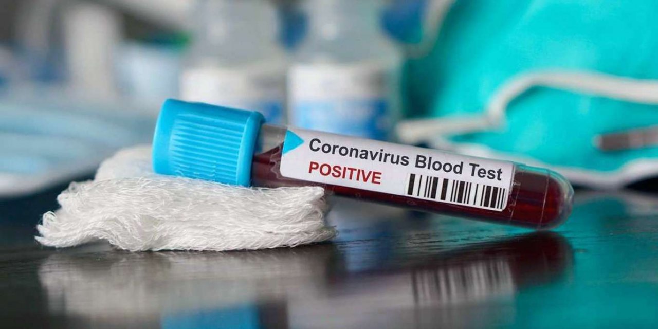 Turkey's daily confirmed coronavirus cases exceed 40,000