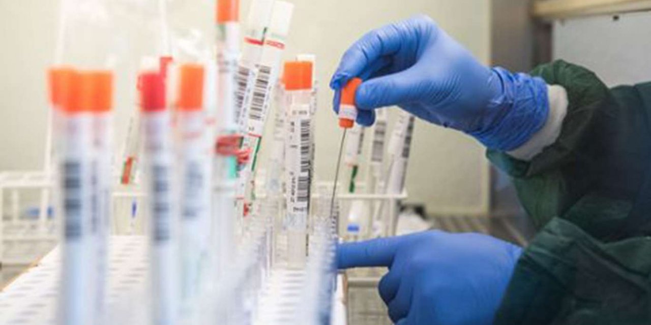 Turkey’s coronavirus death toll rises to 31,892