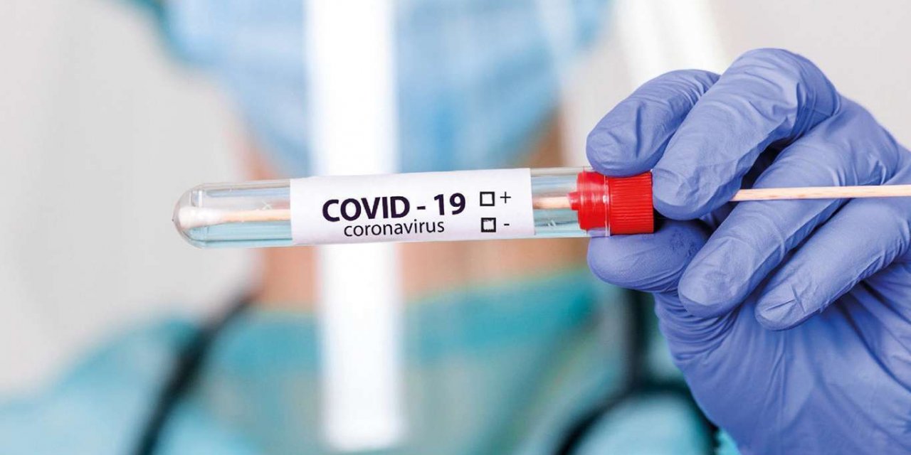 İran'da son 24 saatte Covid-19'dan 374 kişi daha vefat etti