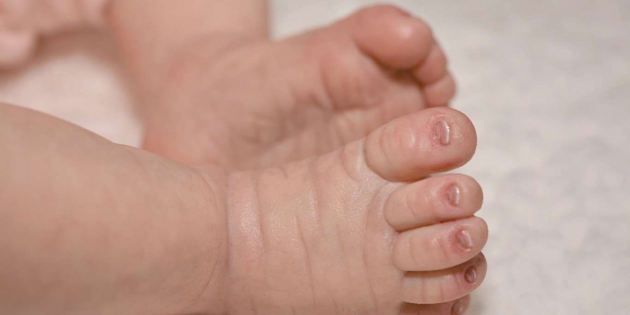 Mali Woman gives birth to nonuplets in Morocco