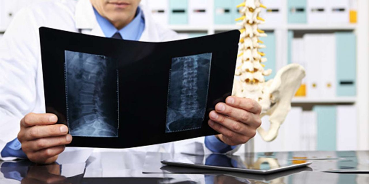 Bel Fıtığı Nedenleri, Belirtileri ve Tedavi Yöntemleri