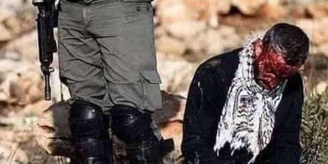 Palestinian succumbs to ZOF-inflicted wounds