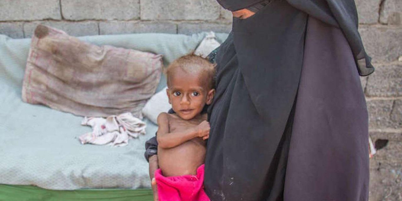 BM'den Yemen'e 50 milyon dolarlık acil yardım