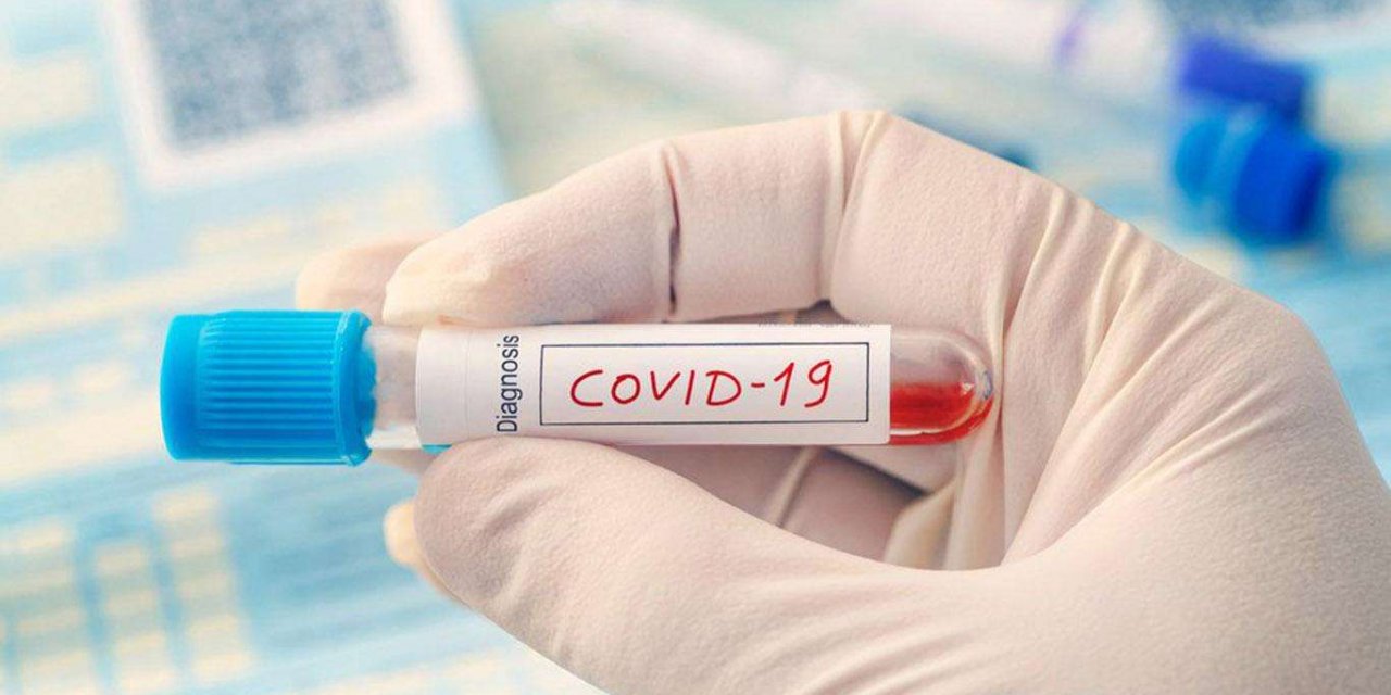 İngiltere'de Covid-19 gevşeme adımı 4 hafta ertelendi