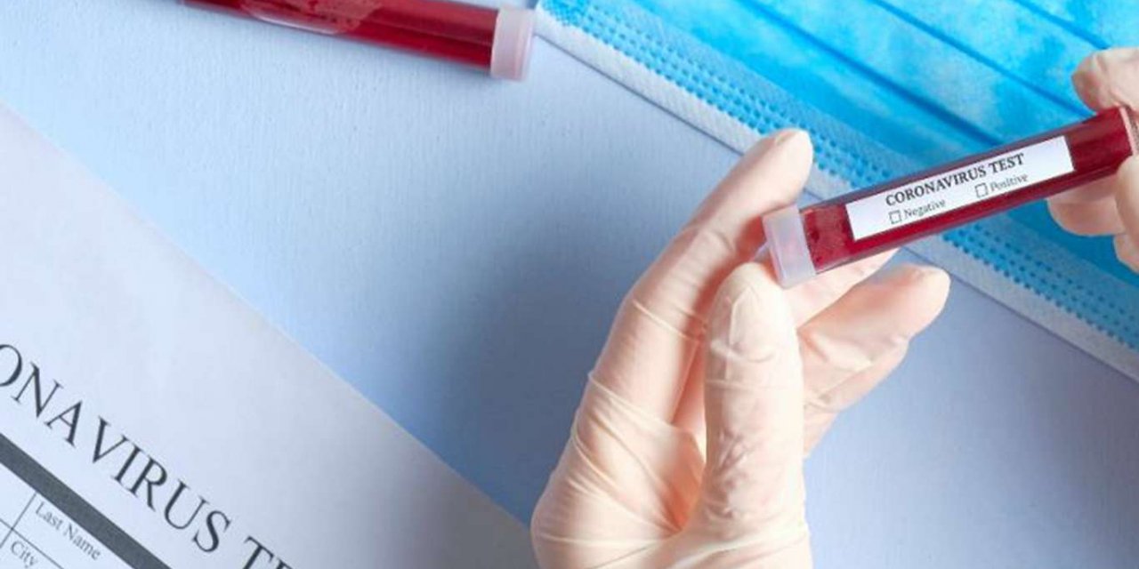 Turkey reports 5,703 new coronavirus cases, 59 deaths