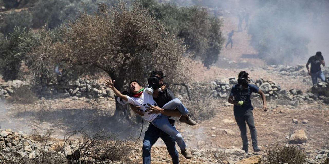 ZOF injures Palestinian boy, others in clashes in Beita
