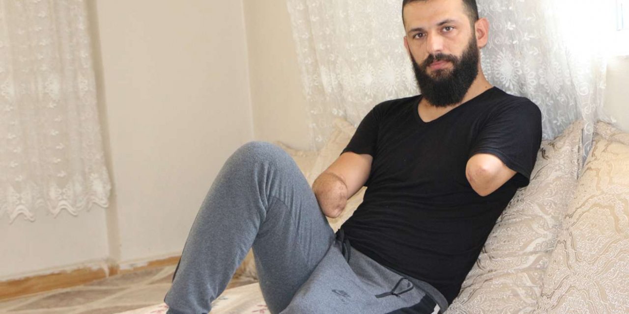 ​Kızının elinden tutup başını okşamak isteyen baba protez yardımı bekliyor