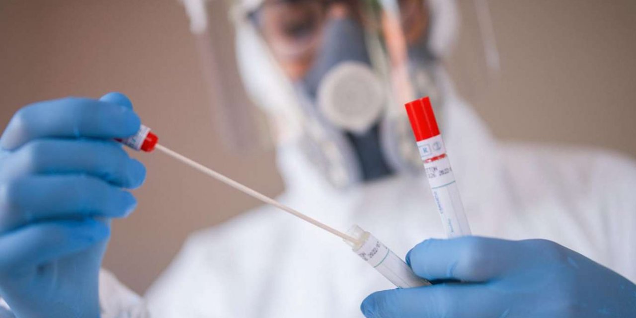 Kolombiya'da Covid-19 nedeni ile ölenlerin sayısı 121 bin 484'e yükseldi