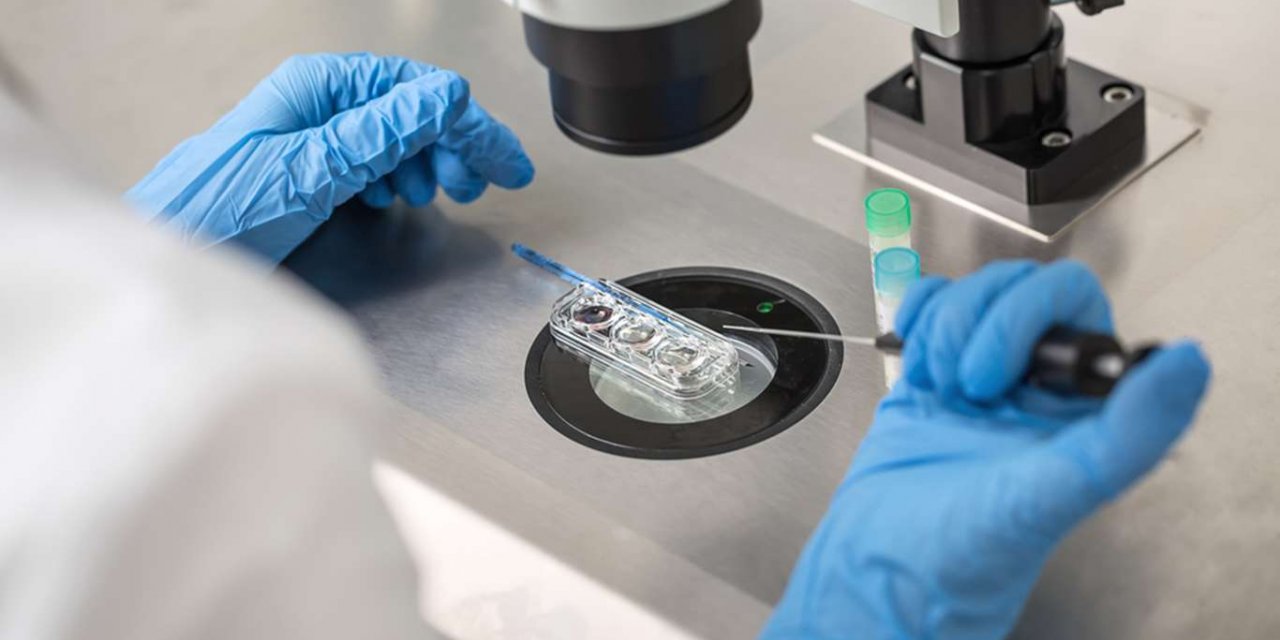 Tüp bebek tedavisi hakkında en çok sorulan sorular