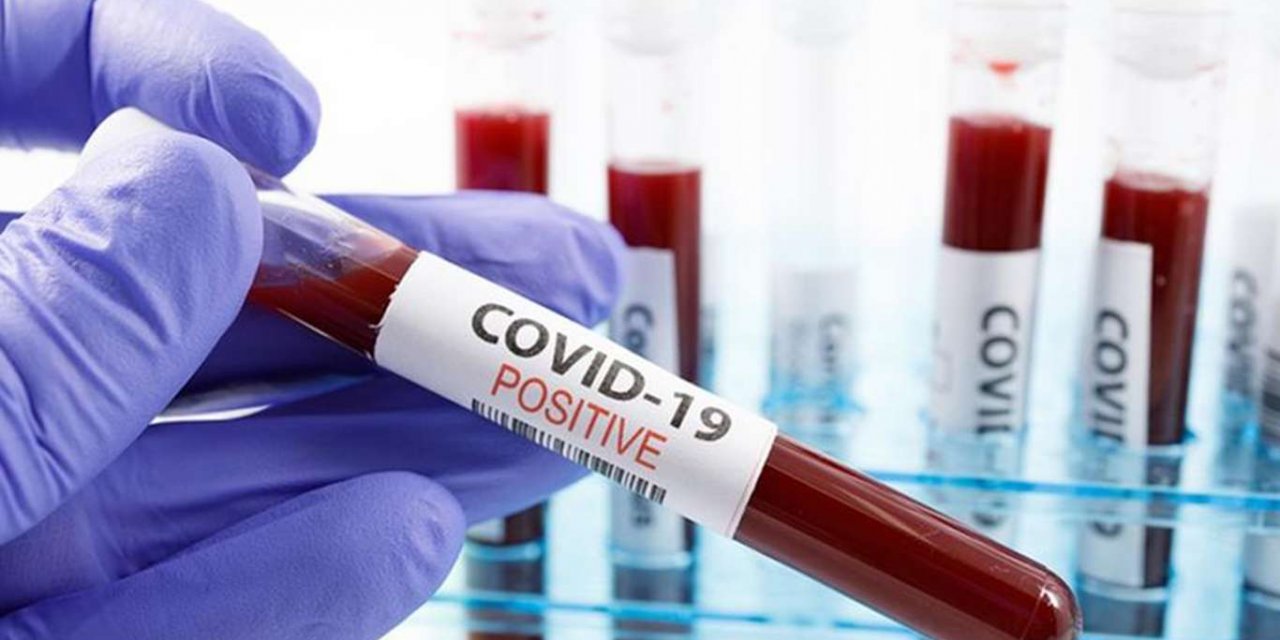 Kanada'da Covid-19 nedeniyle ölenlerin sayısı 26 bin 669 oldu