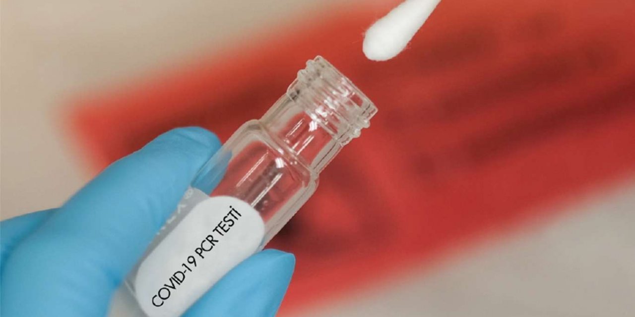 Sağlık ocaklarında PCR testi yapılıyor mu?