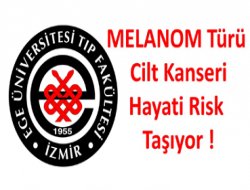 Melanom türü cilt kanseri hayati risk taşıyor